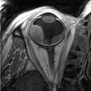 enlarged view