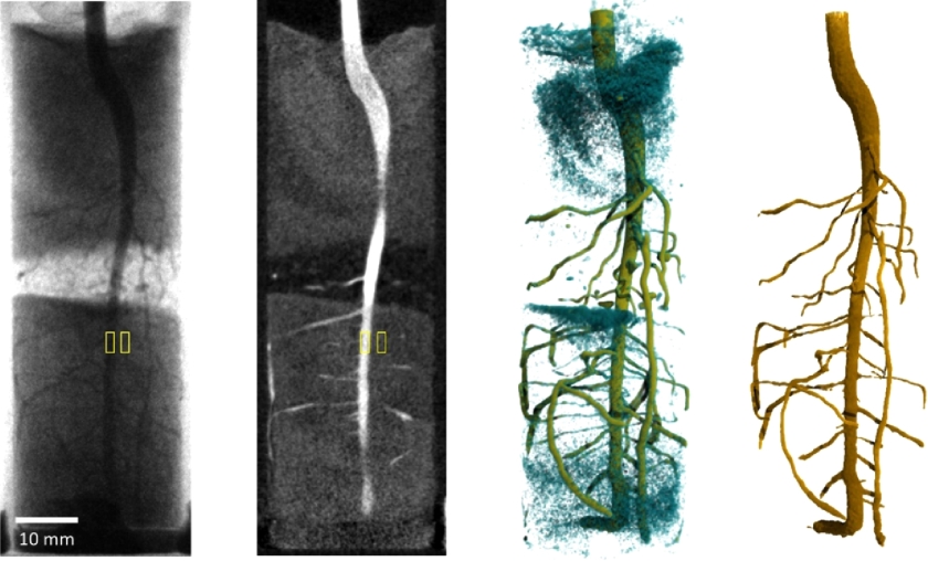 Data from high-speed neutron tomography of a lupine root system grown in sandy soil can be evaluated by different methods.