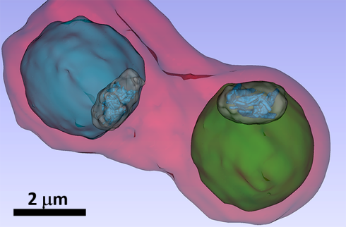 X-ray microscopy at BESSY II reveals how antimalaria-drugs might work