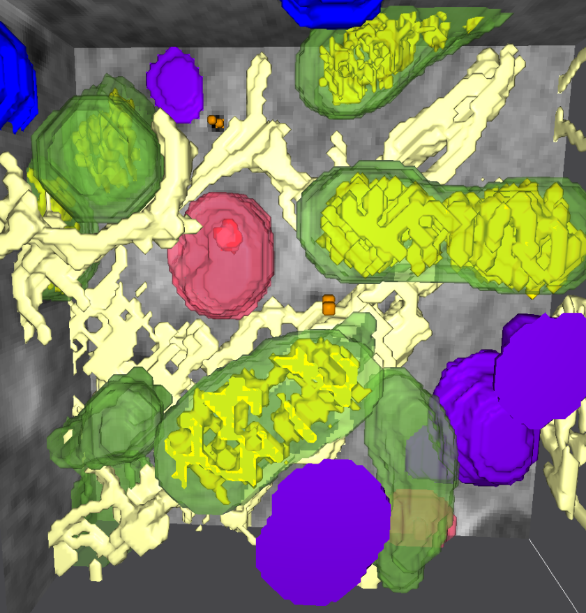 Kombination der einzelnen Aufnahmen zu einem 3D-Bild der Zellarchitektur mit Mitochondrien (gr&uuml;n), Lysosomen (lila), multivesikul&auml;ren K&ouml;rperchen (rot) und dem endoplasmatischen Retikulum (beige).