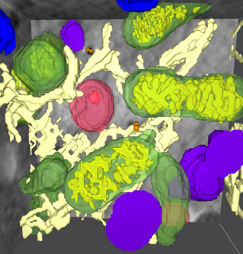 X-ray microscopy at BESSY II: Nanoparticles can change cells