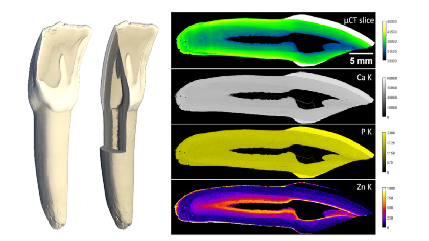 Left: Micro-computer tomography of a complete tooth; the cross-section next to it shows internal structures. Top right: Micro-CT section of the same volume shows absorption. Below are intensity distributions of fluorescence measurements of phosphorus, calcium and zinc. While the main components calcium and phosphorus are distributed homogeneously, the zinc concentration increases towards the pulp.