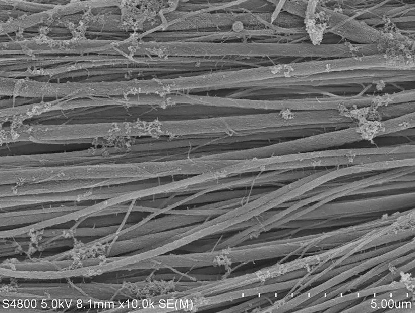 Under the electron microscope: collagen fiber bundle after mineralization with (the bone mineral) calcium phosphate.