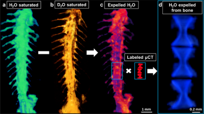 (a) 3D neutron tomography of the spine bones saturated with water (green). (b) 3D neutron tomography after saturation with deuterated water (orange). (c) 3D dataset of the difference, corresponding to the expelled water volume (red). (d) Matching neutron tomography with X-ray &mu;CT scans helped to identify water in the bone extracellular matrix.