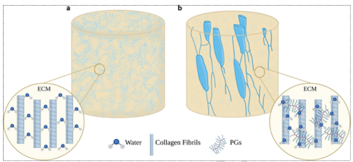 The sketch shows schematically the model for water permeability in a) bone without bone cells: Water is only loosely bound into the organic components of the extracellular matrix. b) In bone with bone cells:&nbsp; Water hardly diffuses through the bone matrix because it is retained by PGs and therefore water mainly flows within LCN, to actuate a bone mechanosensation system.