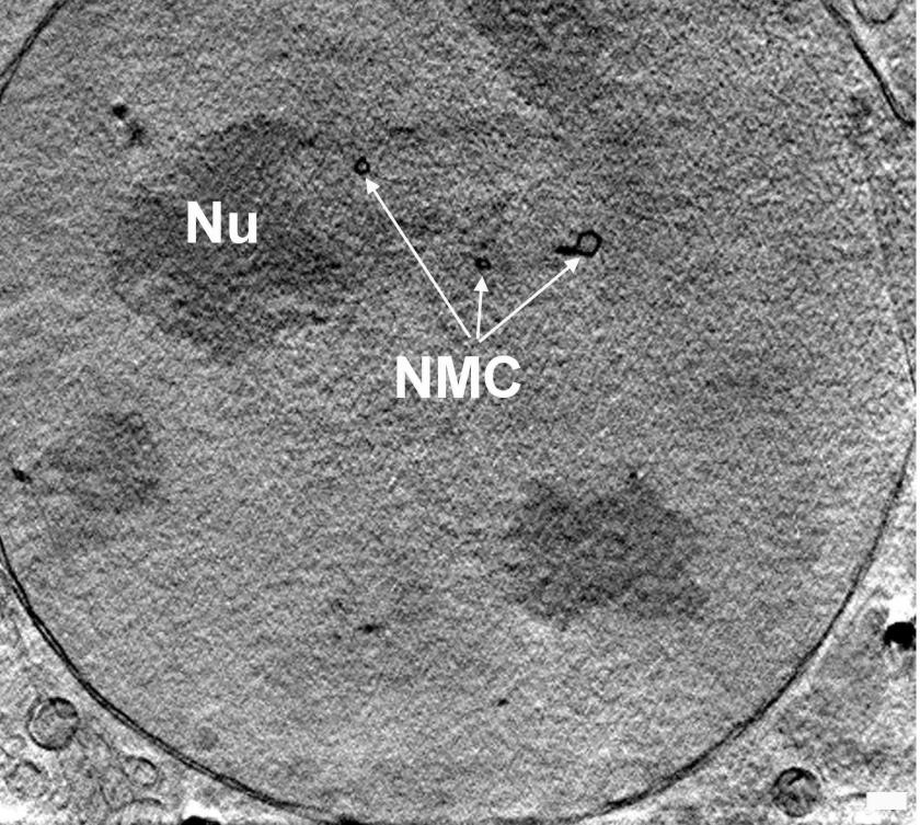 Der 3-D-Schnitt durch den Kern einer Adenokarzinom-Zelle<br />einer Maus zeigt den Nukleolus (NU) und die quer durch den Kern<br />verlaufenden Membrankanäle (NMC) mittels Röntgen-Nanotomo-<br />graphie.<br />Foto: HZB/Schneider
