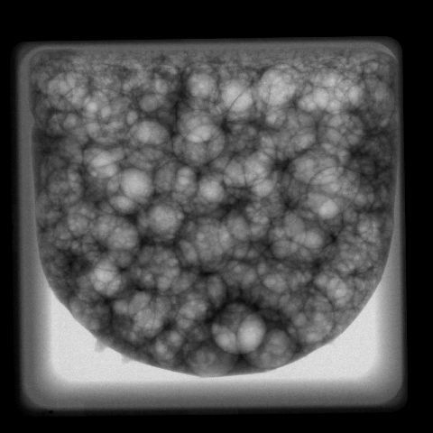 R&ouml;ntgenbild eines fl&uuml;ssigen Metallschaums in Schwerelosigkeit