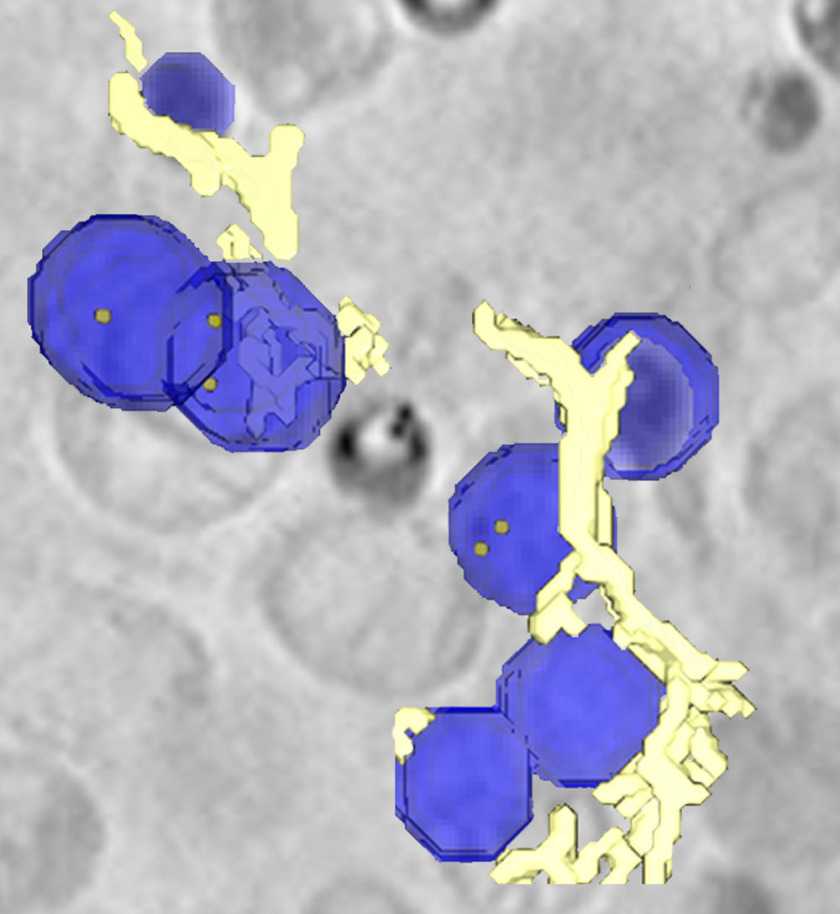 </p> <p>Lipid droplets (blue), containing nanoparticles (orange dots).