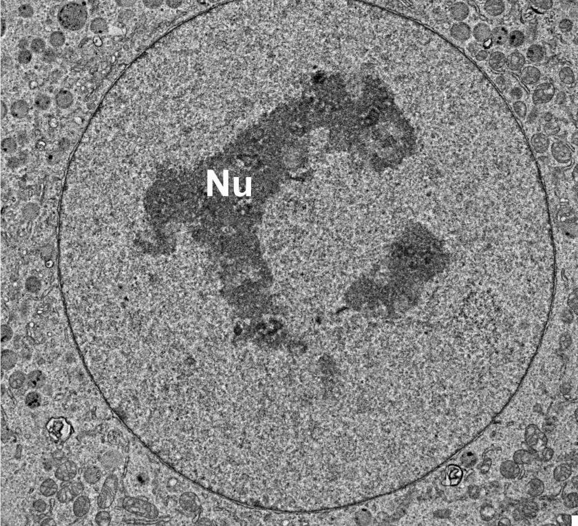 Conventional TEM image of a stained thin section.<br />Photo: HZB/Schneider
