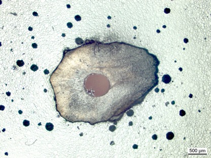 Optical image of a filled root.