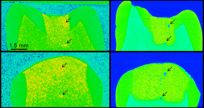Die Neutronentomographie-Aufnahmen (linke Spalte) zeigen, wie sich Flüssigkeit in dieser Zahnfüllung verteilt, während die Röntgen-CT-Aufnahmen (rechte Spalte) Mikrostruktur und Poren der gleichen Probe abbilden. Der Vergleich erlaubt zu sehen, welche Poren mit Flüssigkeit gefüllt sind. 