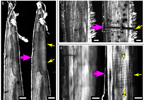 High-energy X-rays leave a trace of destruction in bone collagen